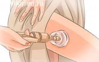 Вакуумный массаж против целлюлита: действие, эффективность, отзывы